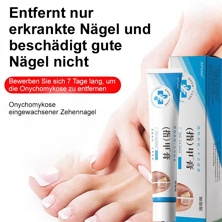 [Schmerzlos und kein Wiederauftreten] Onychomykosesalbe
