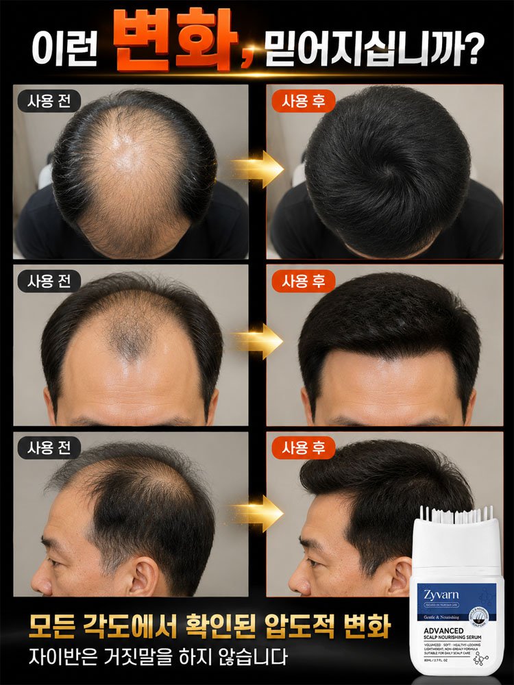 집중 모발 케어 에센스