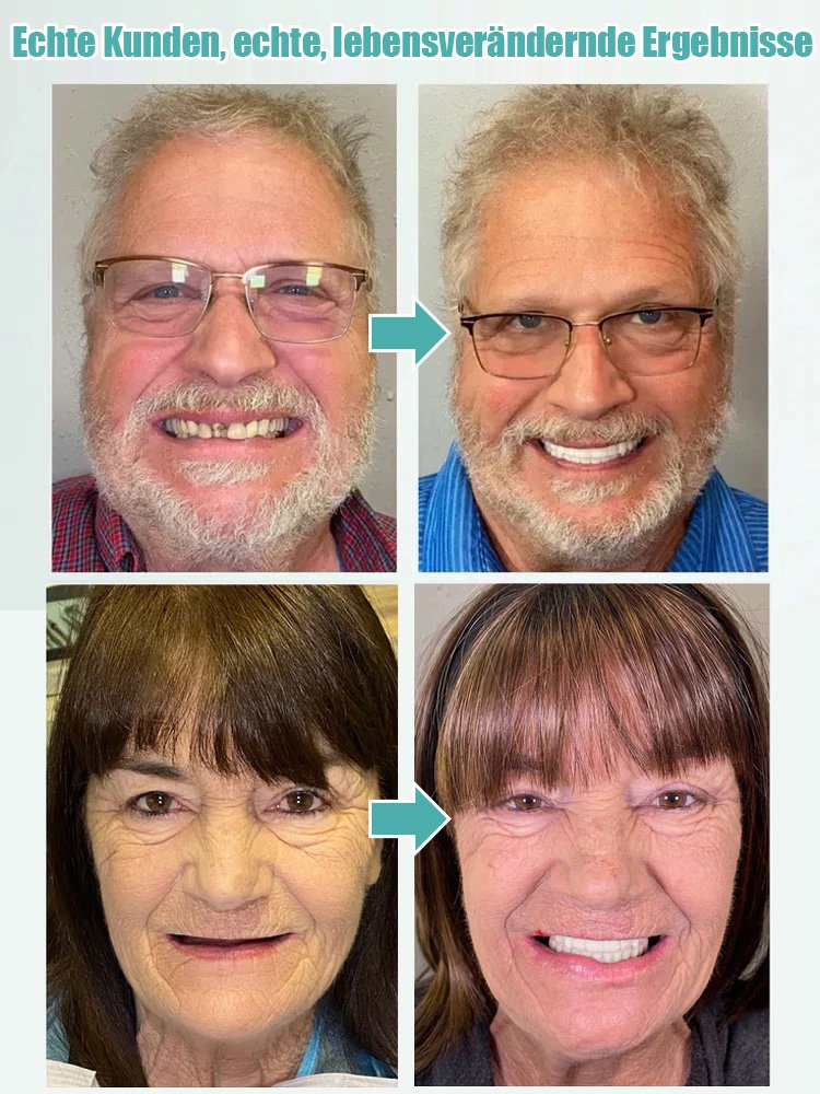 Vollständige, verstellbare Zahnprothese für ein selbstsicheres Lächeln