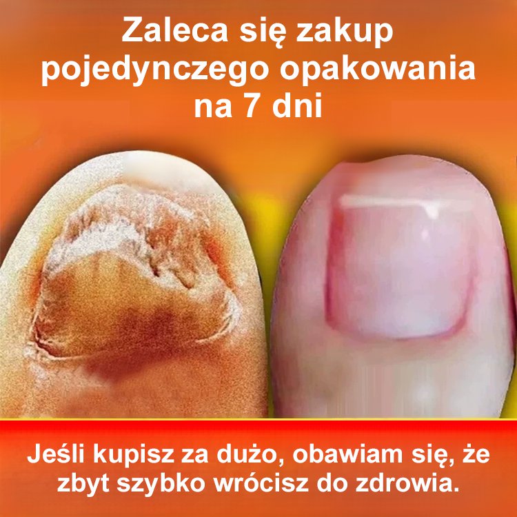 [Bezbolesne i bez nawrotów] Maść na grzybicę paznokci
