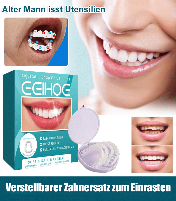 Verstellbare Schnappprothesen