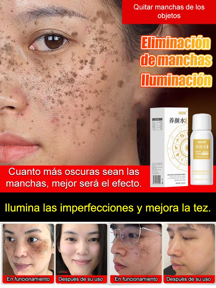 【Spray para eliminar todo tipo de manchas】Spray blanqueador y removedor de manchas