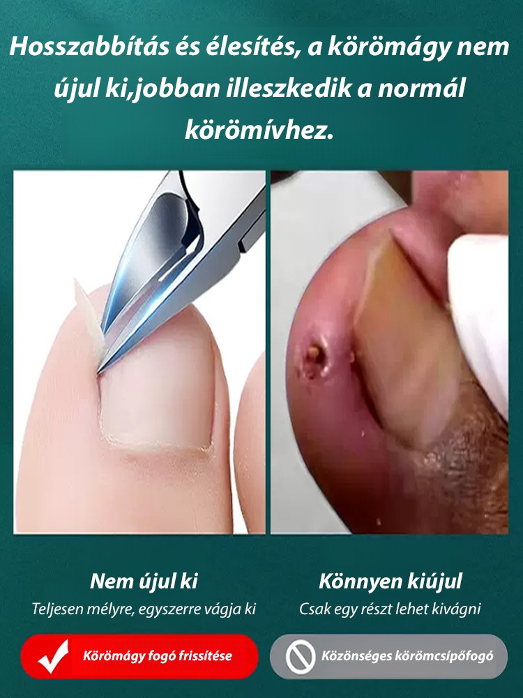 Körömvágó ollók Körömvágó ollók