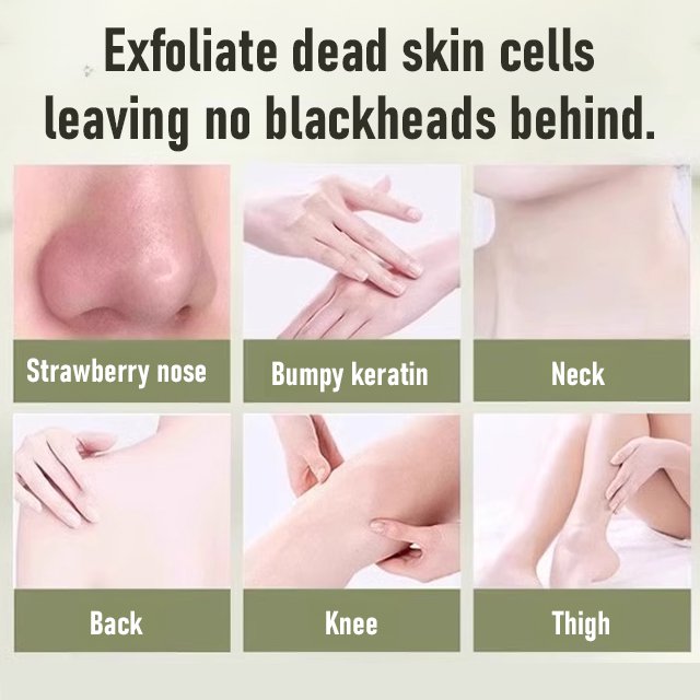 Exfoliating Dead Skin Removal Gel