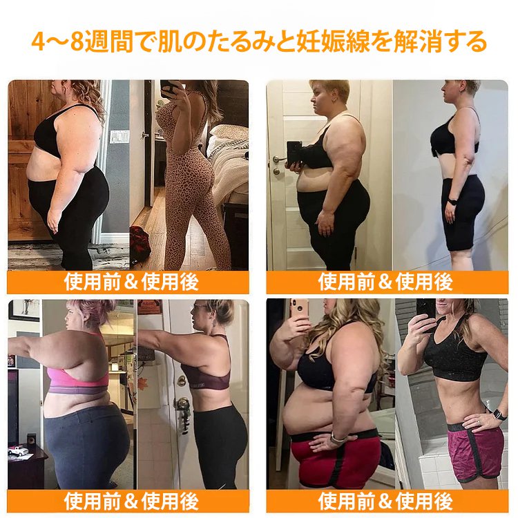 ダイエット用へそパッチ