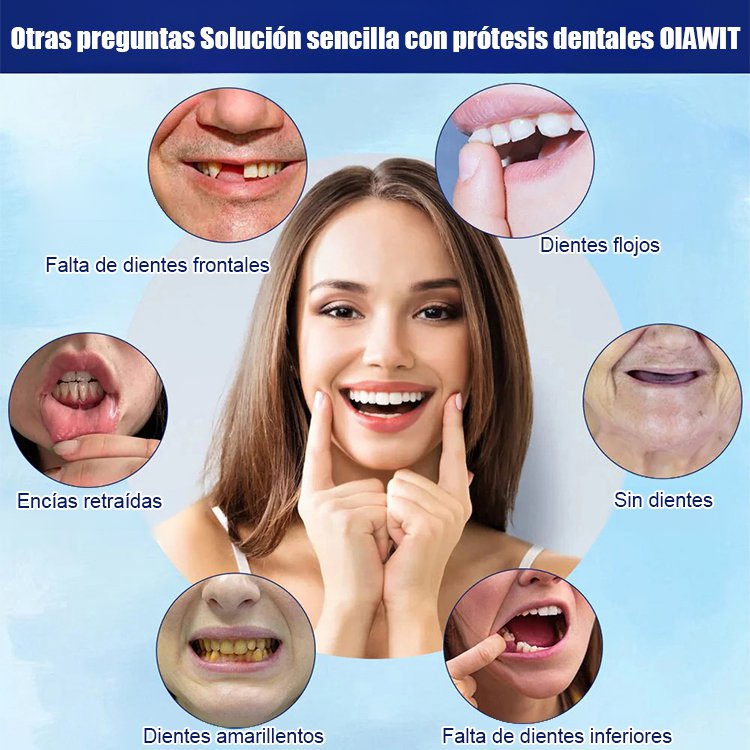 Conjunto de carillas cosméticas para dientes.