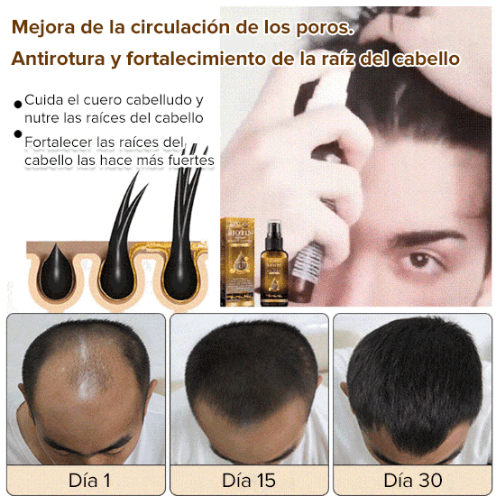 Spray para el crecimiento del cabello con biotina EELHOE