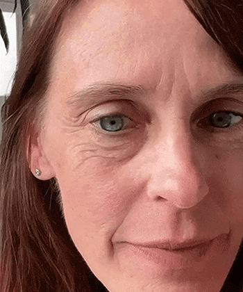 Sofortiges straffendes Augenserum