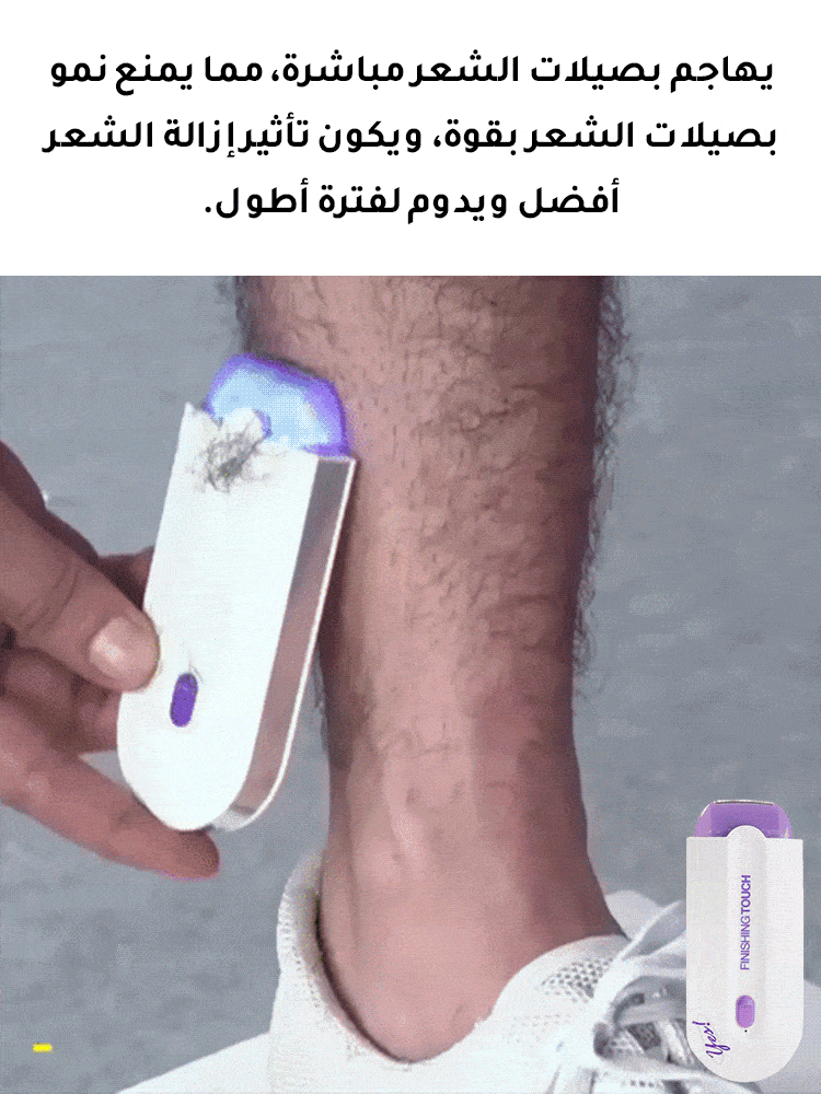 آلة أمريكية لإزالة شعر الجسم بالليزر【الدفع عند الاستلام】