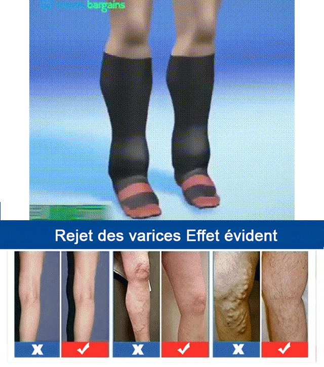 Chaussettes de correction des varices en fibres de cuivre