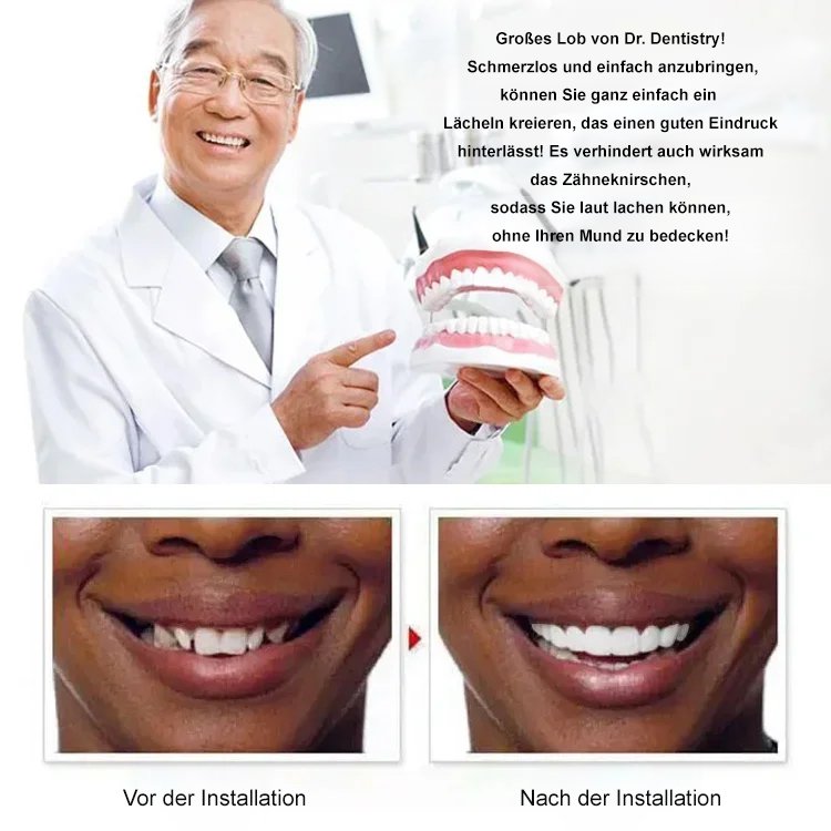 ORALHOE nahtlose Smile-Zahnspange