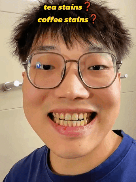 【3 nap alatt eltávolítja a fogkövet】Hidroxiapatit fogkrém