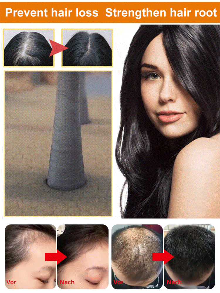 【Niemals Haare verlieren】Anti-Haarausfall-Shampoo