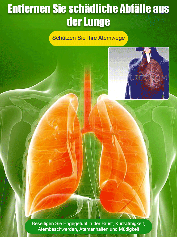 Nach Bestellmenge bestellen