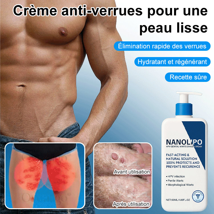 Crème pour l'élimination des verrues et l'adoucissement de la peau.