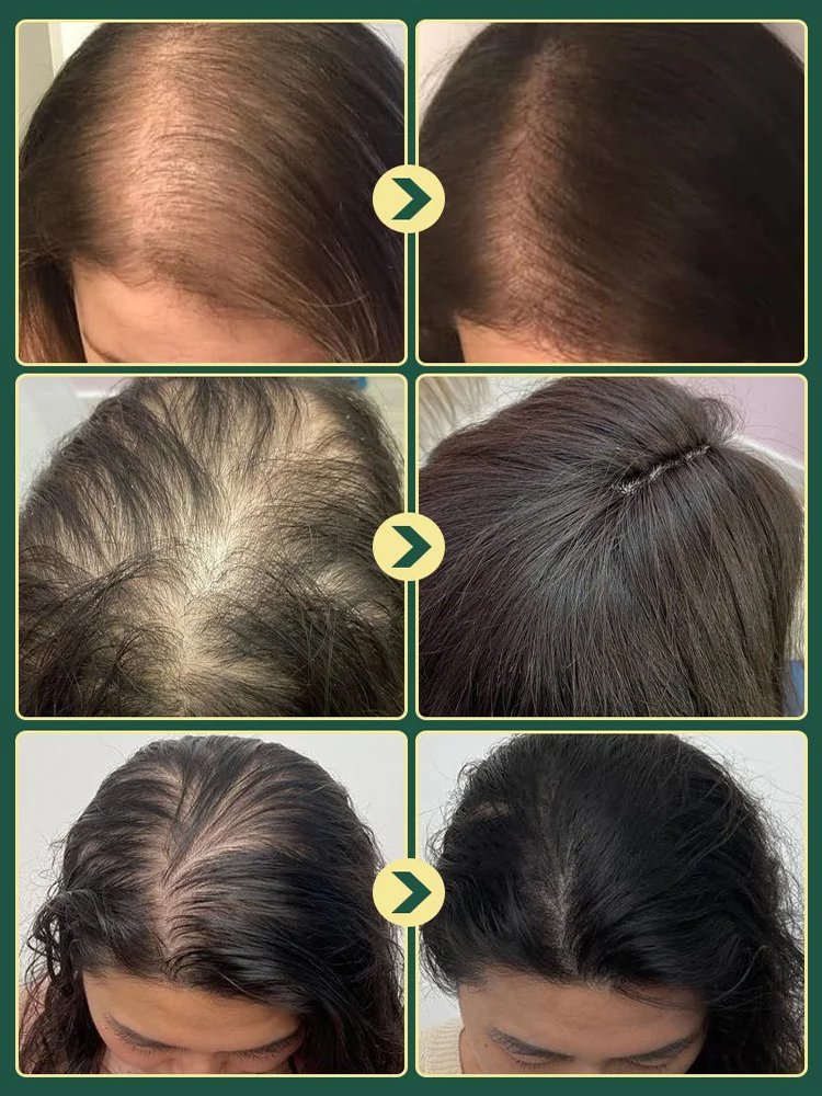 【The less hair, the better effect】Herbal Essence Nourishing Repair Shampoo