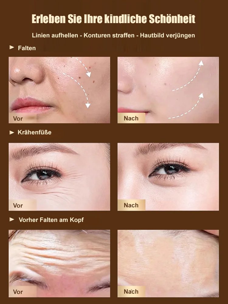 【Faltenentferner】Dr. Yunmei Bozein Anti-Falten-Serum-Lotion