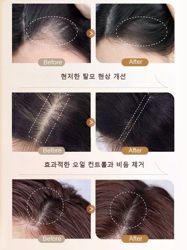 식물성 발모 생강 샴푸