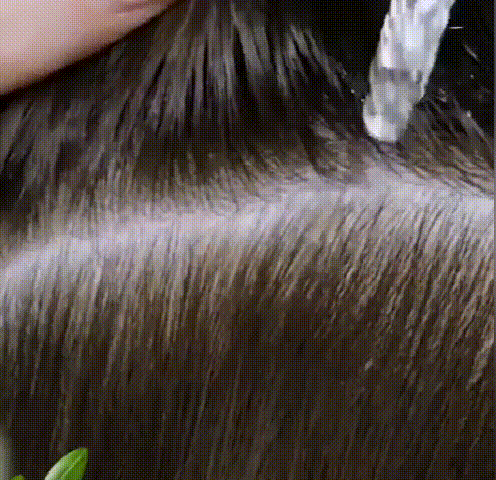 FEG Hair Growth Spray-yaiibaba