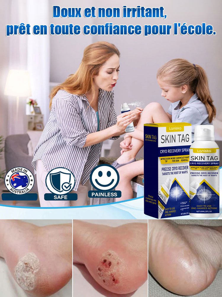 LANISKA spray de soin topique pour points de verrues