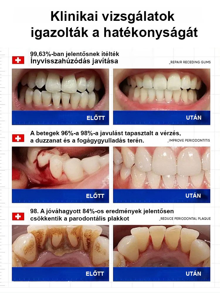 Pezsgőtabletták a fogak regenerálására