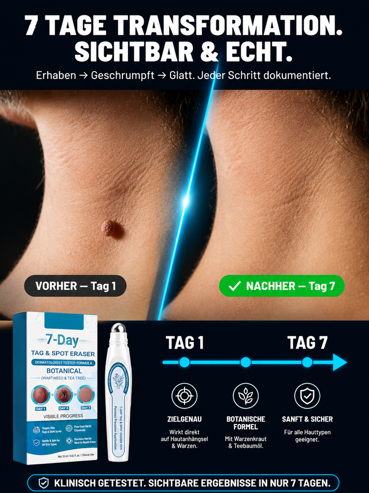 Warzen-Entferner Roll-On für glatte Haut