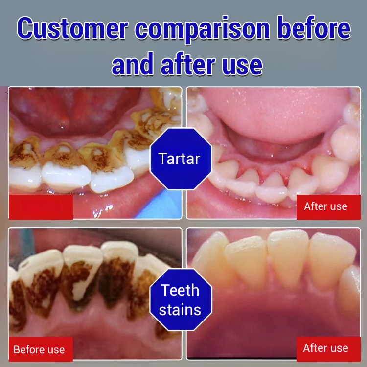 Baking soda toothpaste oral care