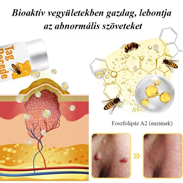  Bee Venom szemölcsök ápoló spray