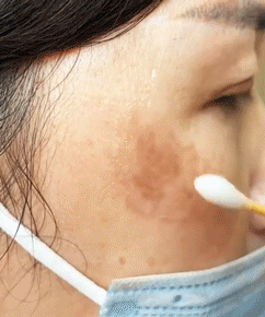 Serum gegen Hautflecken und reparierendes Reinigungsmittel