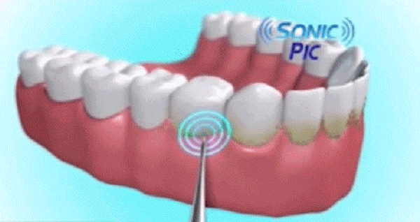 1597144313659526.gif