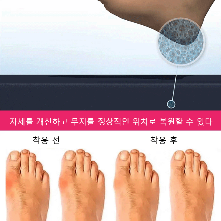 투조 웨지 여성 샌들