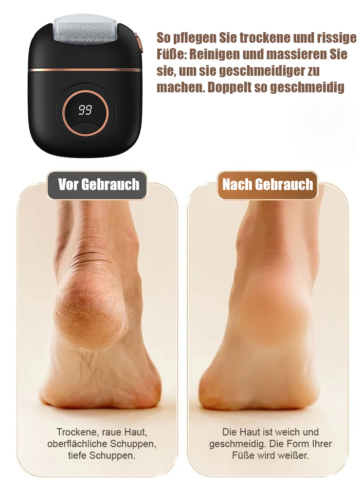 Neue digitale elektrische Fußpoliermaschine