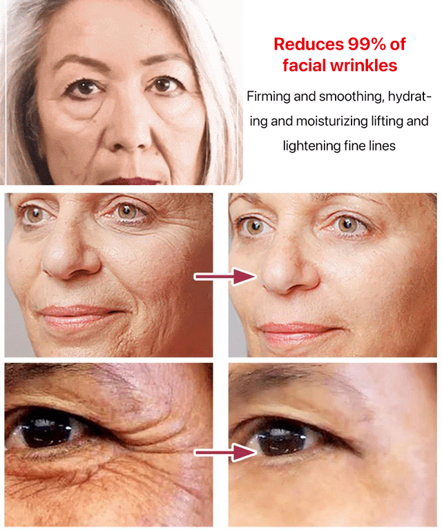 Hot sale ginseng polypeptide anti-ageing essence