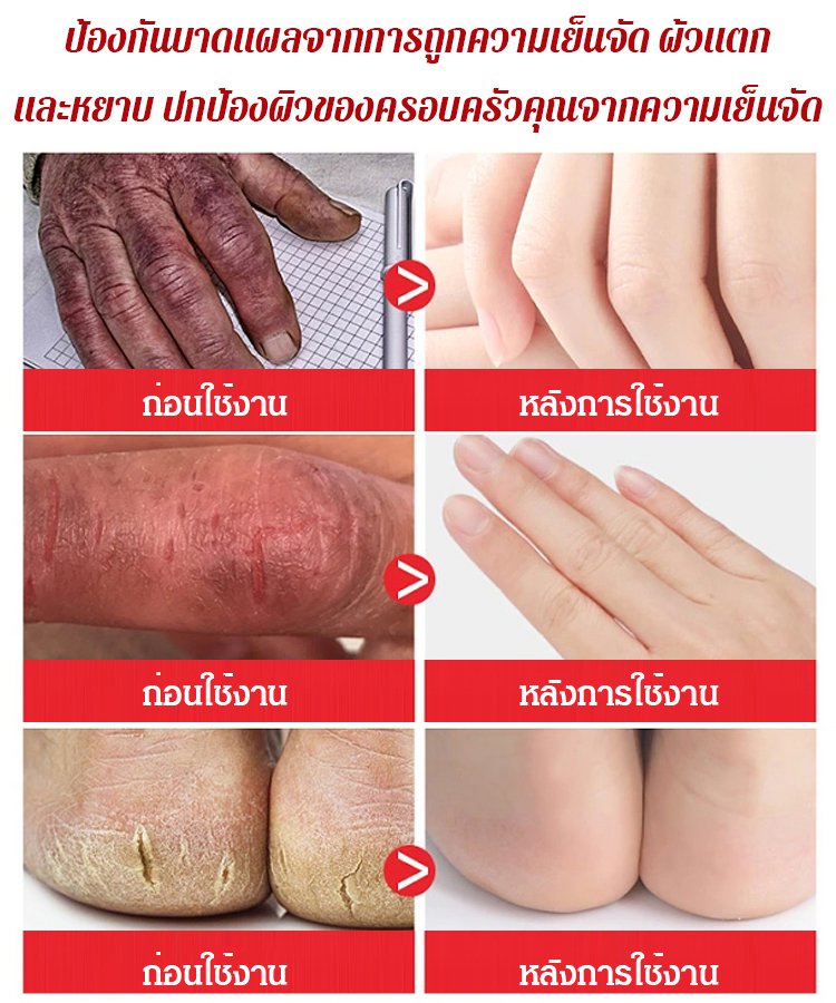 ครีมทามือน้ำมันม้าให้ความชุ่มชื้นป้องกันการแตกร้าว