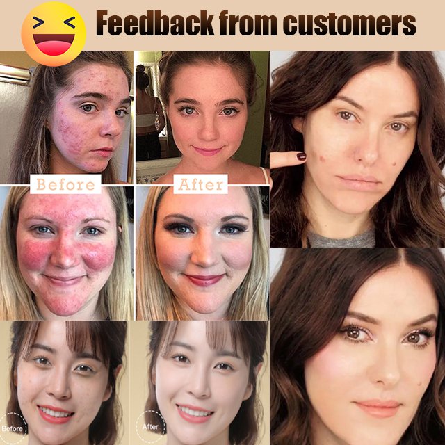 TFTI Tricolor Concealer