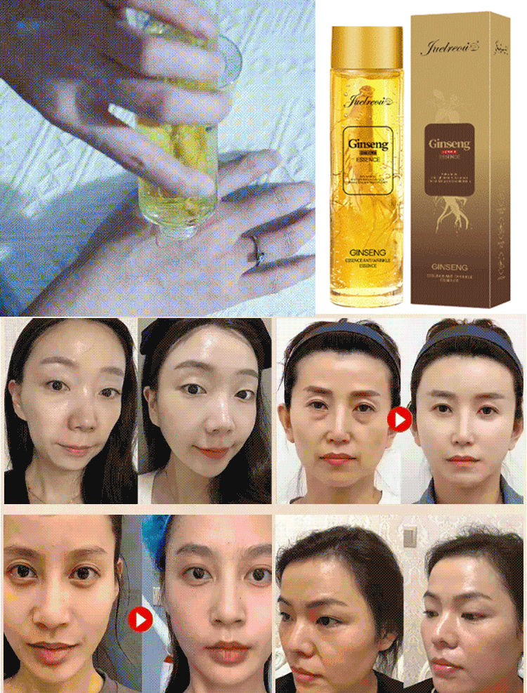 [Peptid-Anti-Falten-Ginseng-Serum (30 Jahre jünger aussehen)