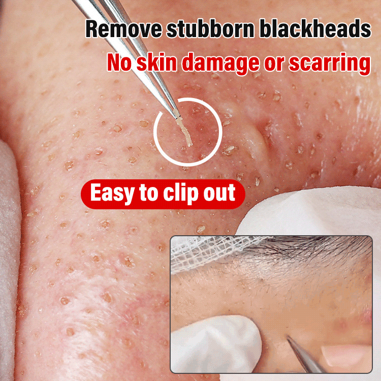 High precision and high hardness cell clamp