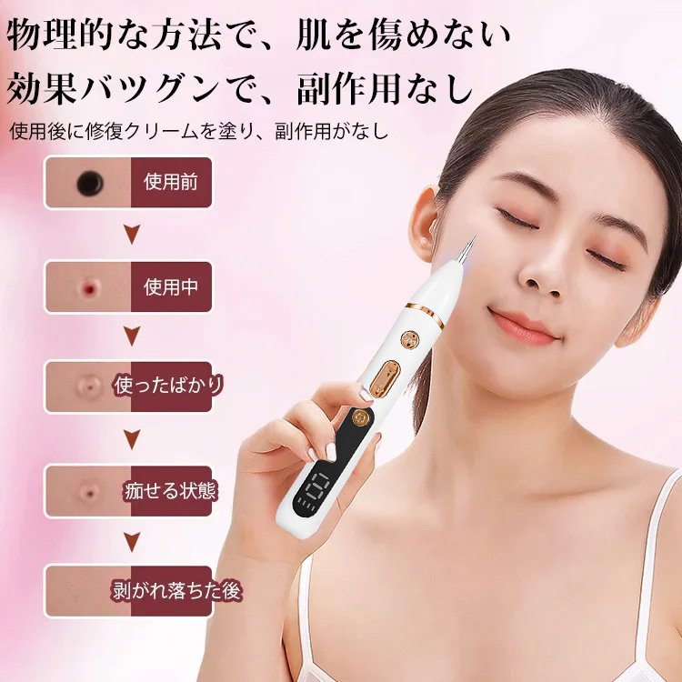 ほくろ・シミ取りレーザーペン