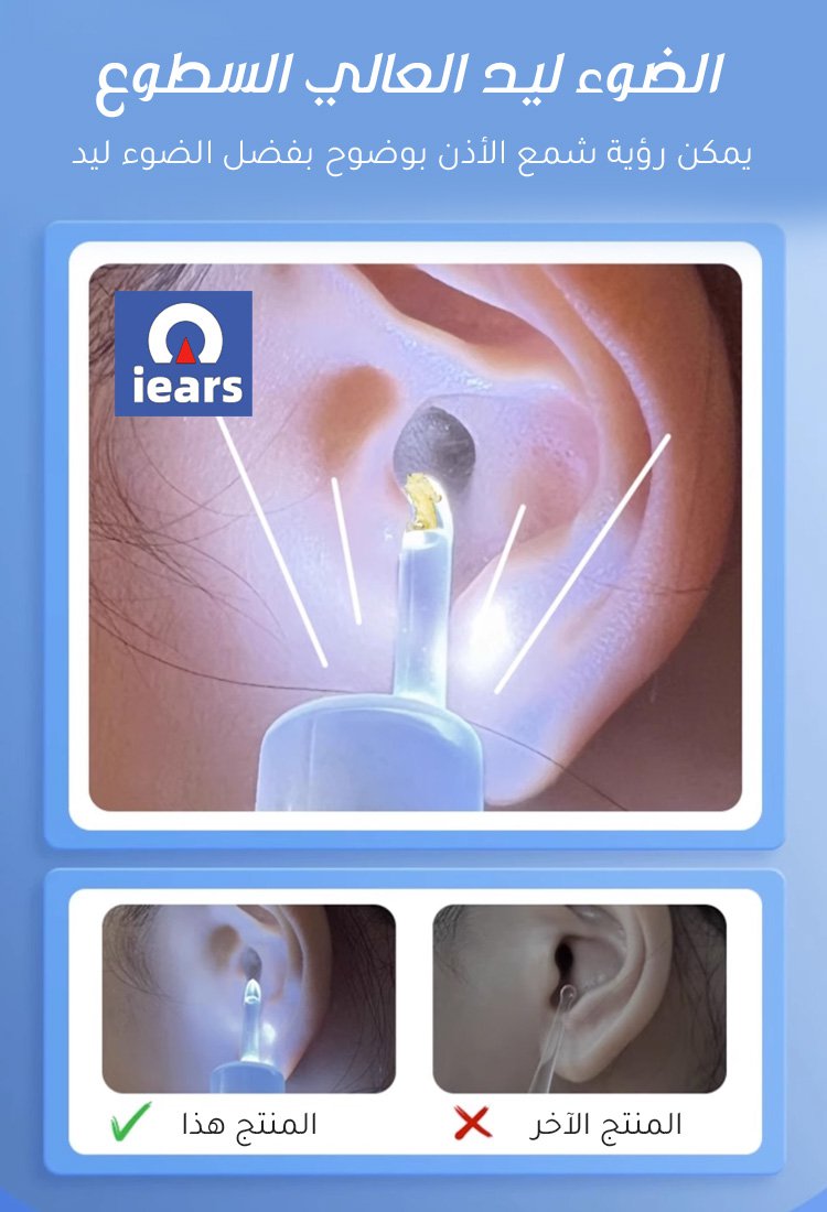 جهاز شفط شمع الأذن الكهربائي