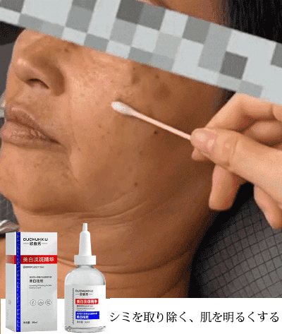 【効果なければ3倍返金】ホワイトニング &シミ取りエッセンスセット、エステ業界”門外不出”の美容液