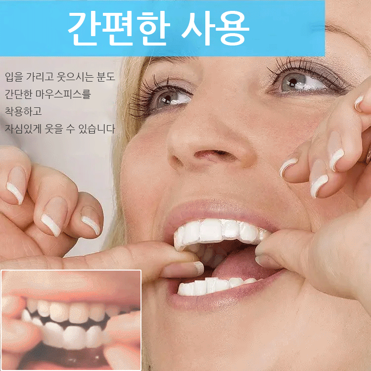 화이트닝 인공 마우스피스