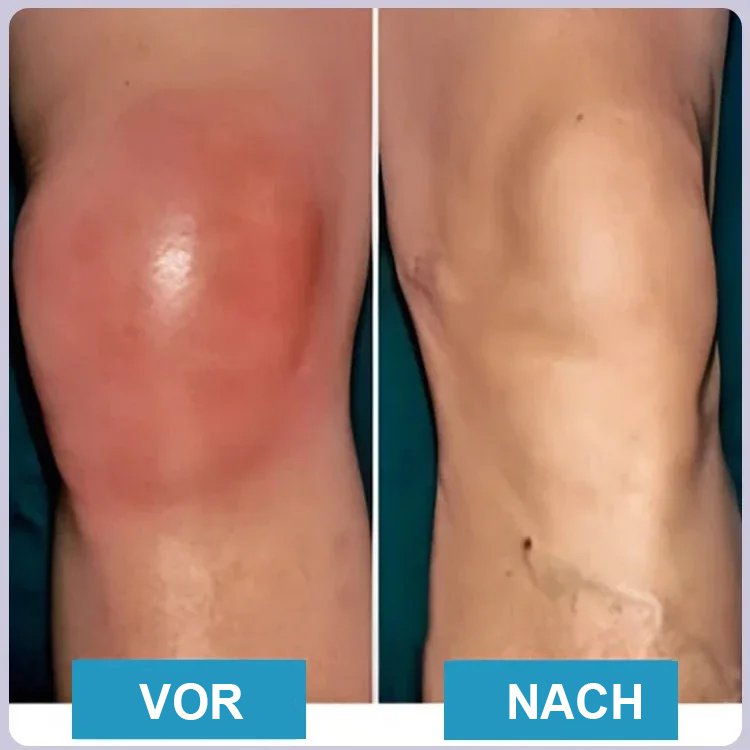 Intelligentes Kniemassagegerät drahtloses Rotlicht-Physiotherapiegerät