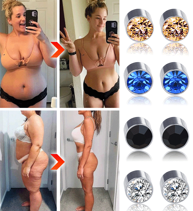 규빅 자기 흡인 살빼기 귀걸이